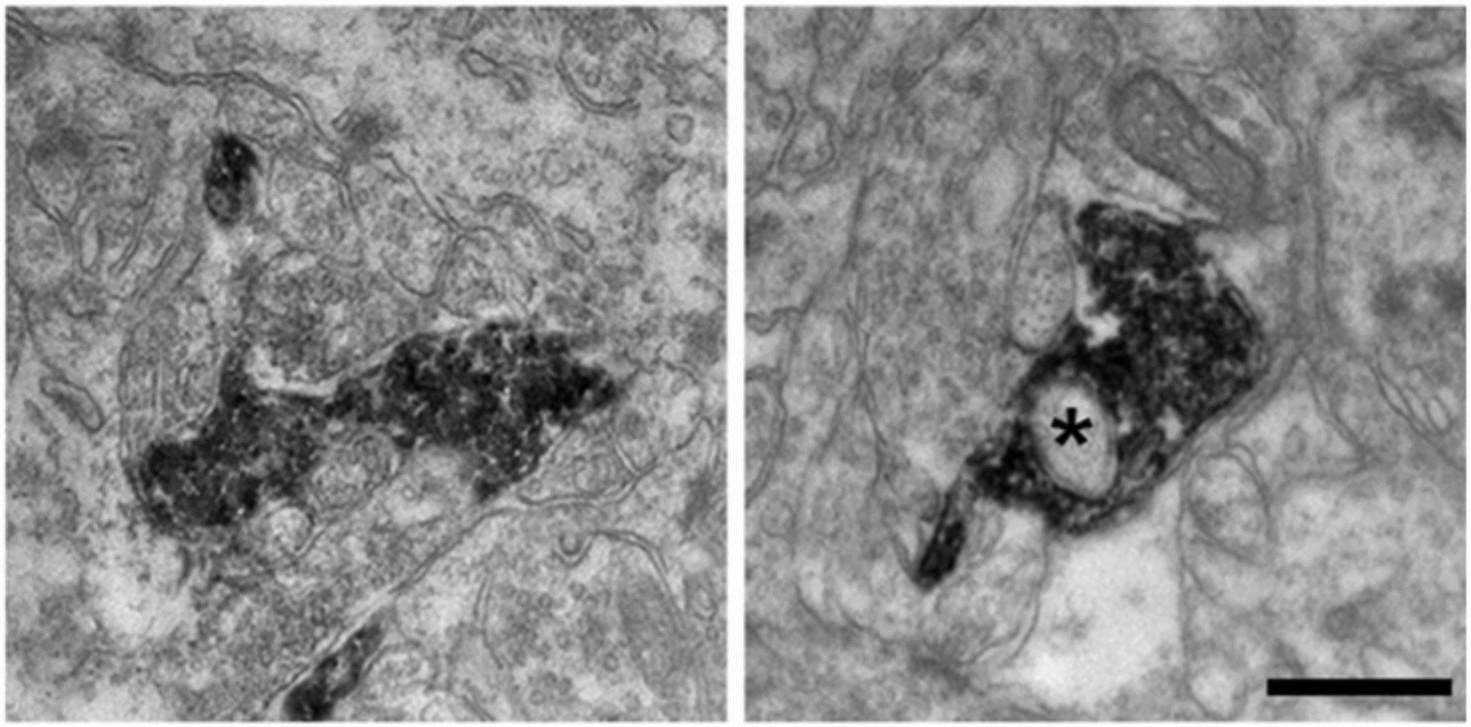 Microglia imaging